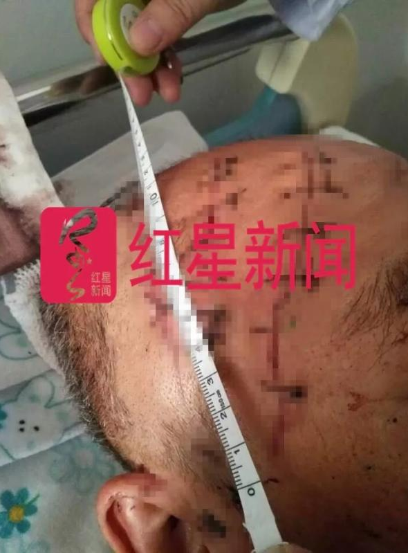 男子入室砍人被反打致死 法院：倒地后继续殴打，防卫过当